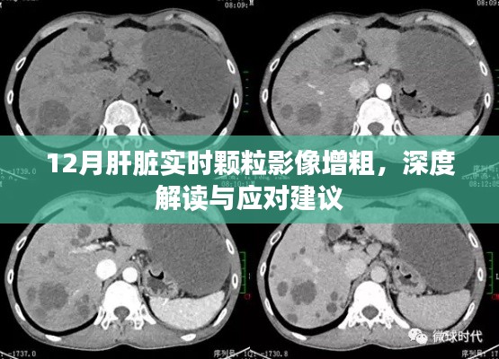 肝脏实时颗粒影像增粗解读与应对建议